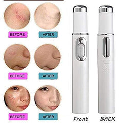 Blue Light Therapy Acne Laser Treatment Pen