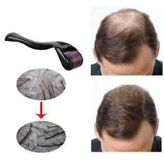 Titanium Needle Roller For Hair Growth