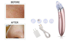 Blackhead Acne & Pimple Extractor