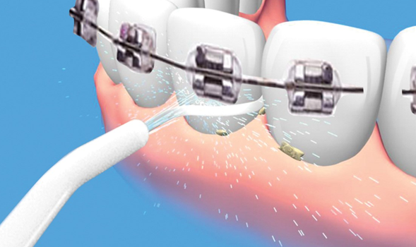 Portable Cordless Dental Water Flosser